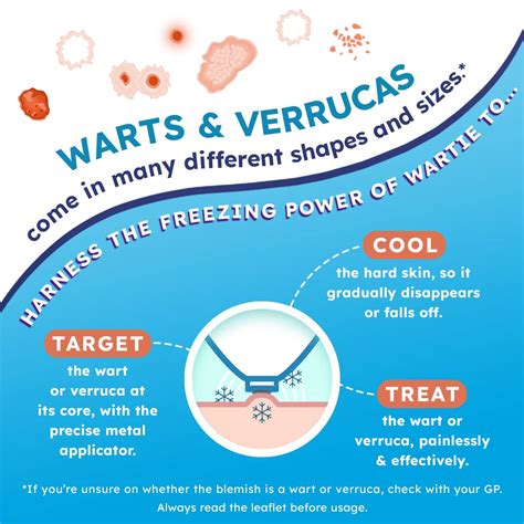 Buy Wartie Freeze Cool Verruca & Wart Remover - Wart Freeze Removal ...