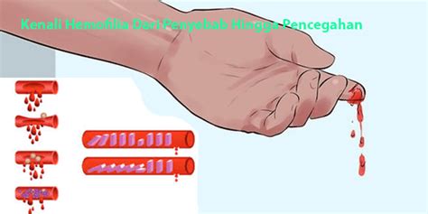 Image result for A Computer Vision Based Lane Detection Approach