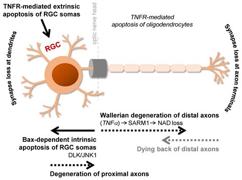 Multifactorial Pathogenic Processes of Retinal Ganglion Cell ...