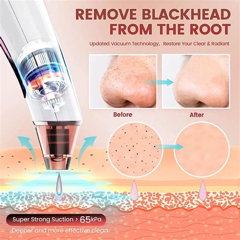2023 Newest Blackhead Remover Pore Vacuum - Rechargeable Pore Cleanser ...