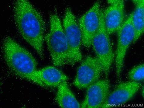 S100A6 antibody (66098-1-PBS) | Proteintech