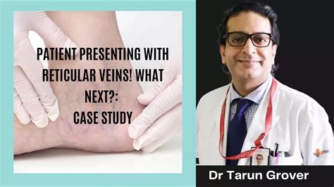 A Patient presented with Reticular Veins. What's next?