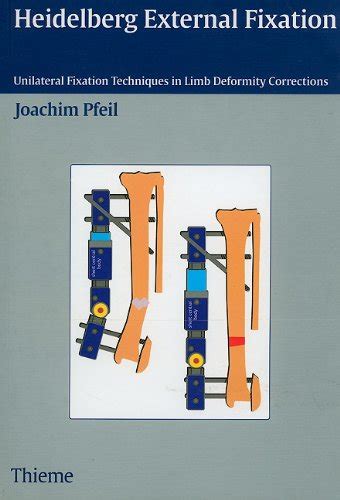 Buy Heidelberg External Fixation: Unilateral Fixation Techniques in ...