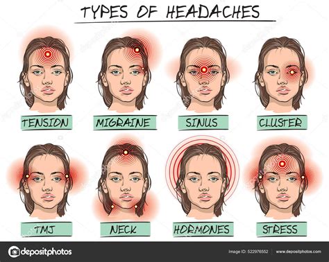 Why Do I Wake Up With Headaches Behind My Eyes at Gemma Adcock blog