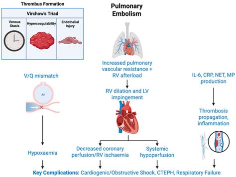 Pulmonary Embolism in Acute Ischaemic Stroke: Evolving Evidence ...