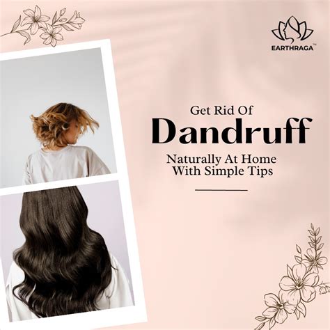 Natural Remedy For Dandruff - Dandruff Treatment At Home | Earthraga