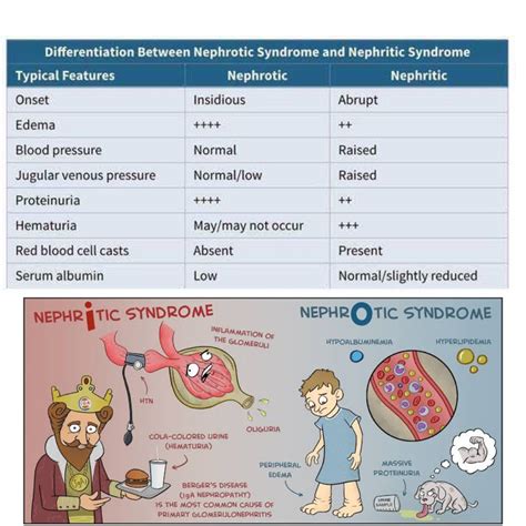 Nephritis Vs Nephrosis