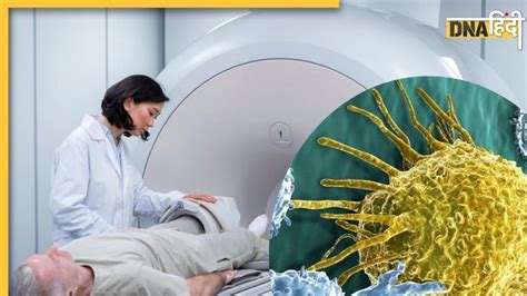 CT Scan Cancer Risk Latest News and Updates in Hindi – CT Scan Cancer ...