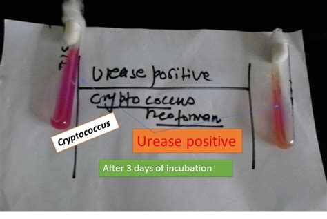 Image result for Urease