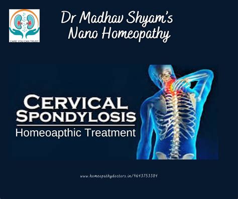 Cervical spondylosis, also known as cervical osteo... | Nano Homeopathy ...