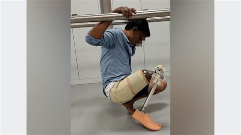 IIT Guwahati develops affordable prosthetic leg with advanced features