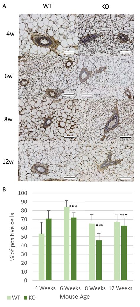 The Role of Csmd1 during Mammary Gland Development
