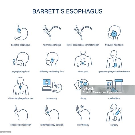 Barretts Esophagus Symptoms Diagnostic And Treatment Vector Icon Set Stock Illustration ...