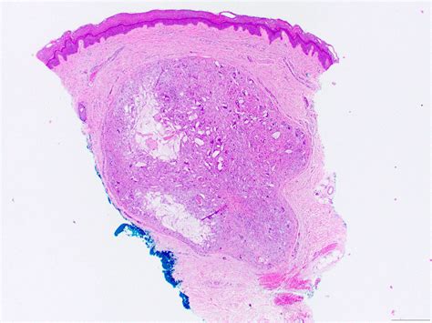 Image result for Differential Evolution Mutation Algorithm