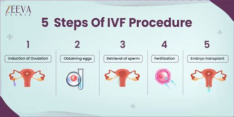 IVF Procedure Explained 的图像结果