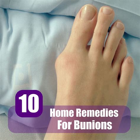 Acne Home Remedies For Dry Skin: Cure Bunions Home Remedies