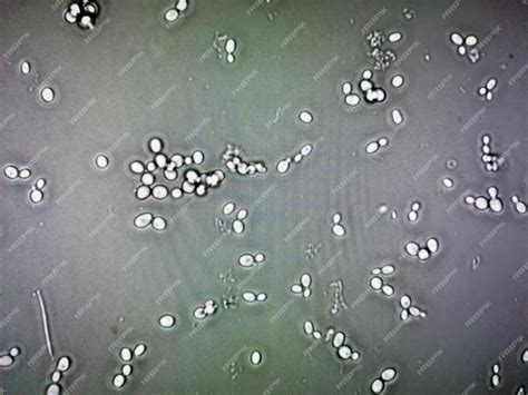 Premium Photo | Budding yeast cells in patient urine urinary tract ...