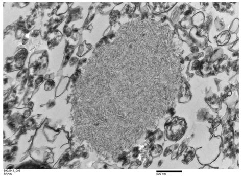 Lafora Disease and Alpha-Synucleinopathy in Two Adult Free-Ranging ...