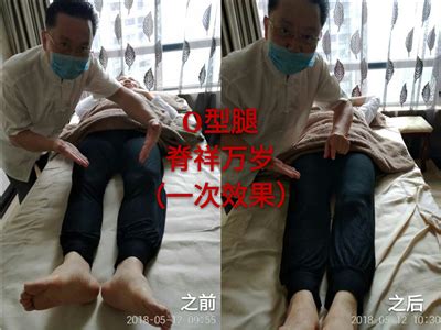 腿型调理 - 特色项目 - 台湾传统软手法培训-叶慧阳