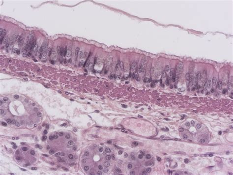 Pseudostratified Ciliated Columnar Epithelium
