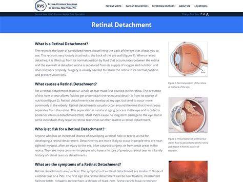 Causes of detached retina - statassist