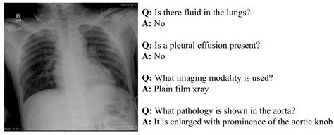 A Survey on Multimodal Large Language Models in Radiology for Report ...