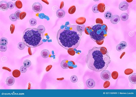 Monoclonal Antibody Treatment in Plasma Cell Leukemia (PCL) - Isometric View 3d Illustration ...