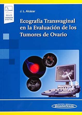 Buy Ecografía transvaginal en la evaluación de los tumores de ovario ...