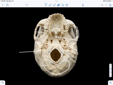 Process Bone 的图像结果