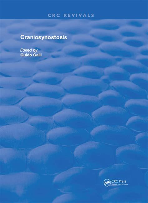 Buy Craniosynostosis (Routledge Revivals) Book Online at Low Prices in ...