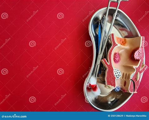 Image result for Loop Colonoscopy