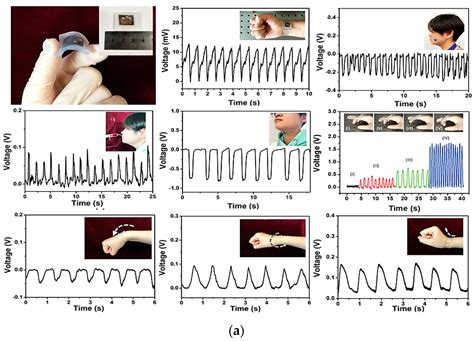 Wearable Sensors and Smart Devices to Monitor Rehabilitation Parameters ...
