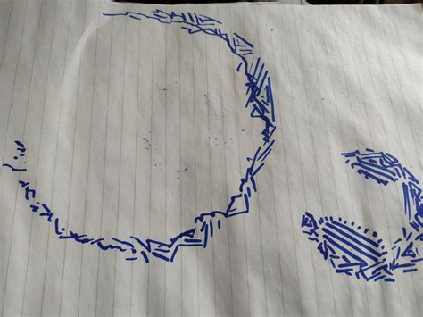 I occasionally see weird flashing lines that make a blind spot in my vision in the shape of a ...