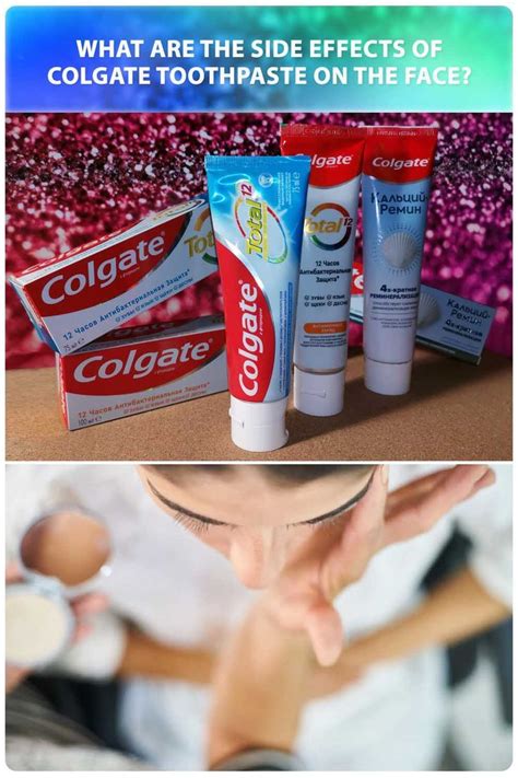 Image result for Does Toothpaste Help Pimples