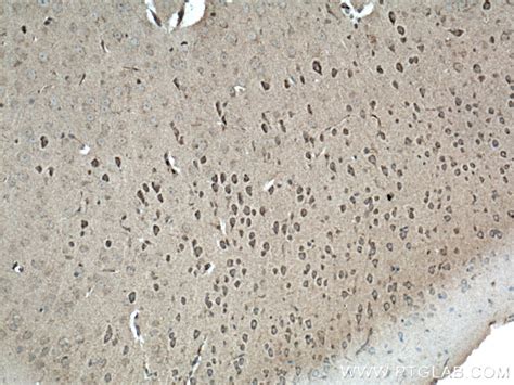 NBAS antibody (14683-1-AP) | Proteintech