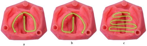 Enhancing Effective Scanning Techniques for Digital Impression in ...