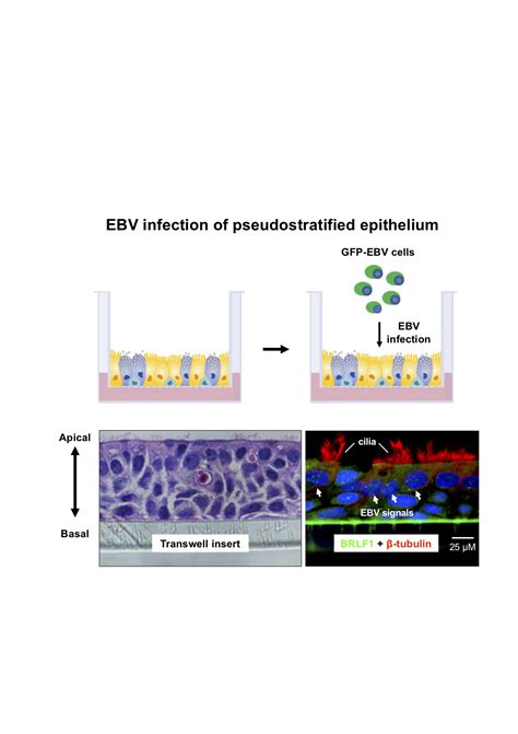 Epstein–Barr Virus Infection of Pseudostratified Nasopharyngeal ...