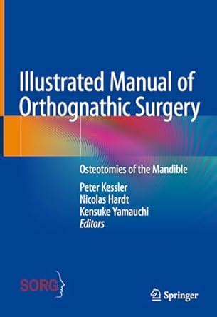 Illustrated Manual of Orthognathic Surgery: Osteotomies of the Mandible ...