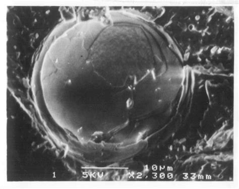 Surfactant therapy for respiratory distress syndromes