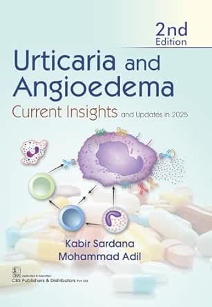 Urticaria and Angioedema Current Insights and Updates in 2025 eBook ...