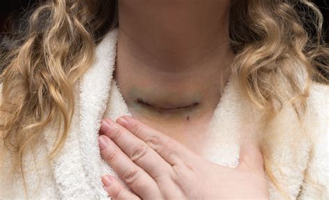 Best Thyroid Surgeon Hadapsar Pune | Dr. Vinod Gore – Silver Leaf Clinic