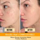 Buy Korean Cleansing Face Pad Online at Best Price - Wildglow