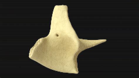 3D Model of Malar Bone (Left)