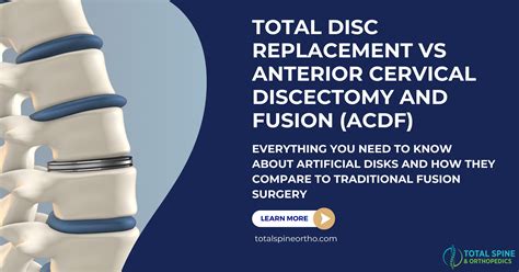 Total Disc Replacement VS Anterior Cervical Discectomy and Fusion - All ...