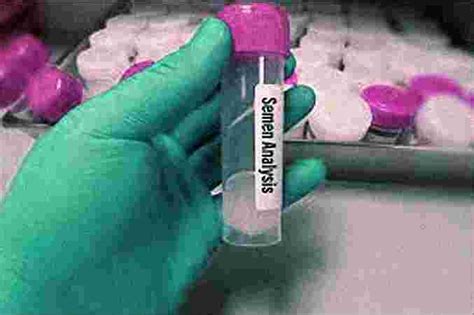 Best Semen Analysis - Blood Test & Path Labs in Jaipur, Top Semen ...