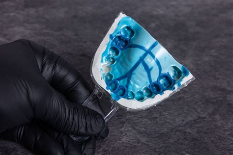Mastering Dental Impressions: Material Types and 10 Tips for Success - COLTENE