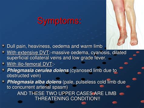 PPT - DEEP VENOUS THROMBOSIS PowerPoint Presentation, free download ...
