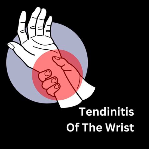 Tendinitis of Wrist: Symptoms, Causes & Treatment - Center For Senior Health