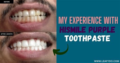 Rtyopi Toothpaste 的图像结果