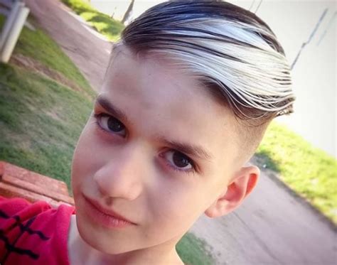 Poliosis: Un hombre y su hijo comparten una peculiaridad genética que ...